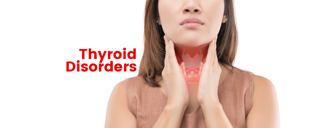 Illegal Dietary Supplements, Molecular Testing for Thyroid Cancer