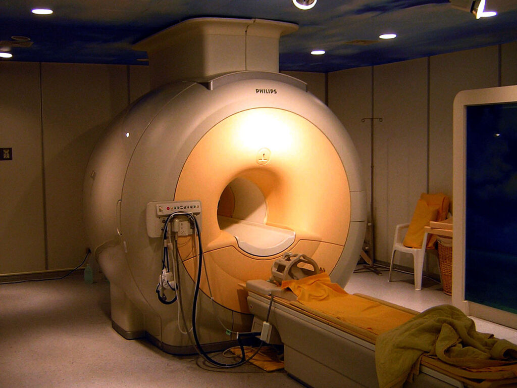 magnetic resonance imaging (MRI) coils Market