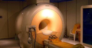 magnetic resonance imaging (MRI) coils Market